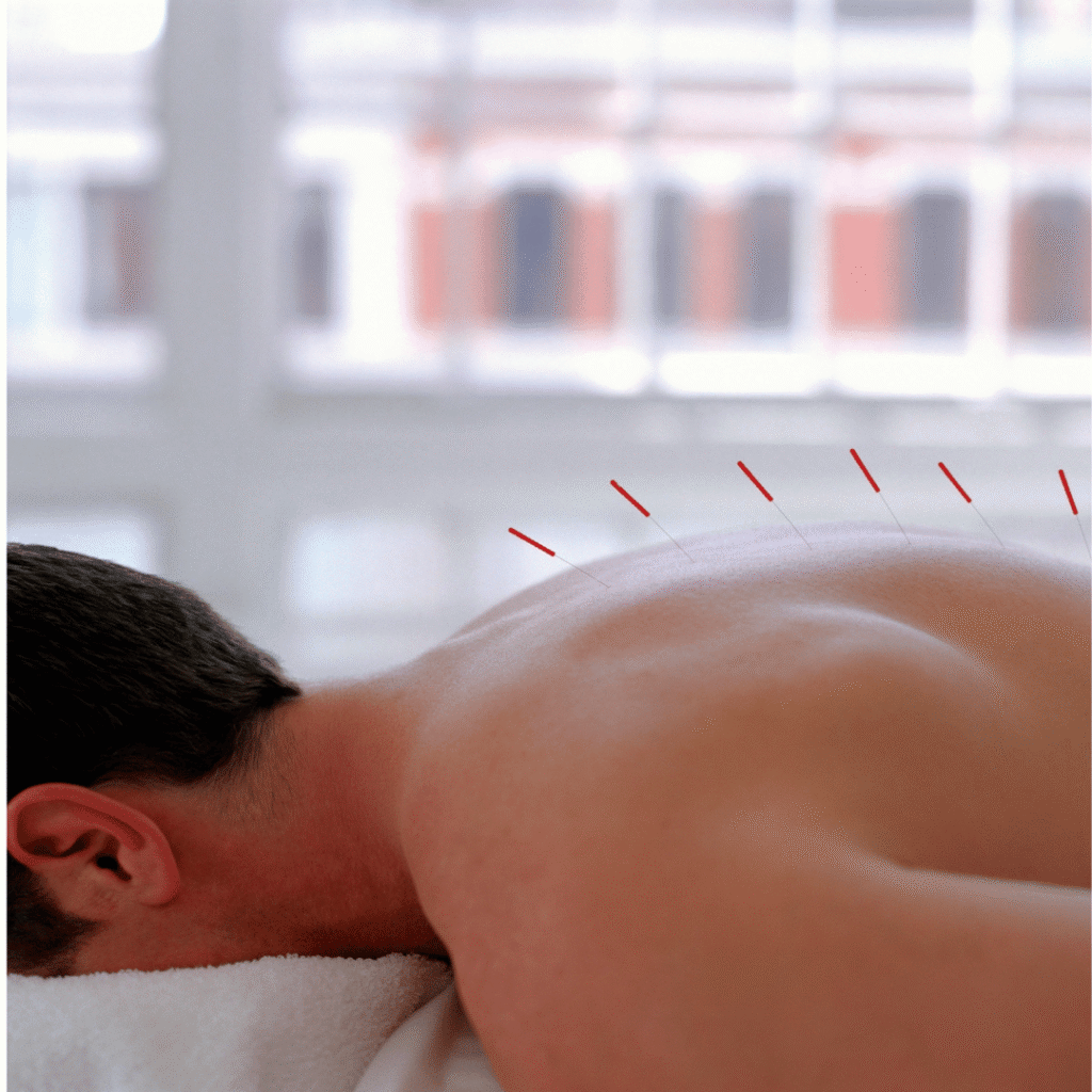 Acupuncture Therapy Whitby